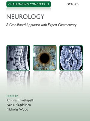 cover image of Challenging Concepts in Neurology